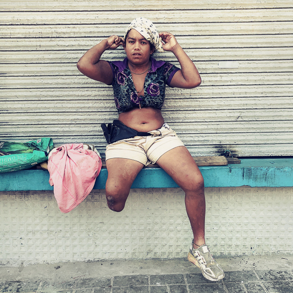 A disabled Colombian sex worker (Barranquilla, Colombia)
